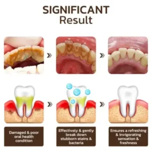 Seurico™ Niacinamide Whitening Toothpaste