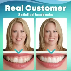 Winter Sale EzySmile™ SnapOn Silicone Veneers