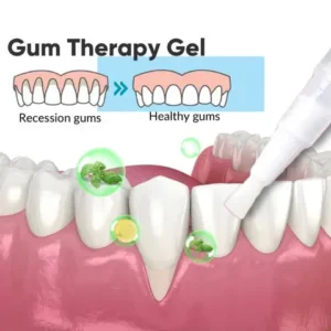 Gum Therapy Gel